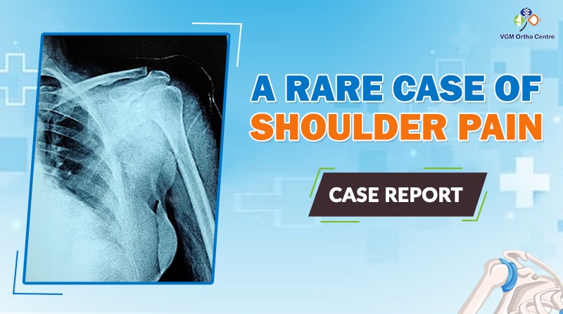 A rare case of shoulder pain treatment in coimbatore