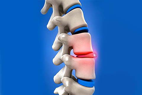 Spine decompression surgery in coimbatore